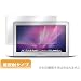 OverLay Plus for MacBook Air 11�C���`(Late 2010) �ᔽ�˃^�C�v�t���ی�V�[�g