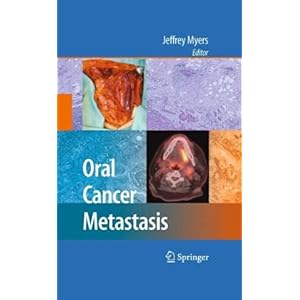 【クリックでお店のこの商品のページへ】Oral Cancer Metastasis [ハードカバー]