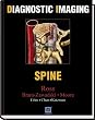 Diagnostic Imaging: Spine, 1e