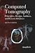 Computed Tomography: Principles, Design, Artifacts, and Recent Advances (Press Monograph)