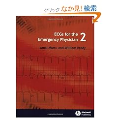 ECGs for the Emergency Physician 2