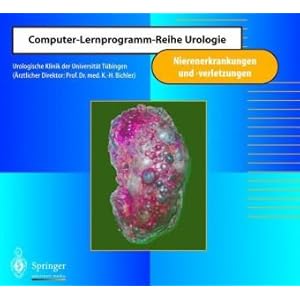 【クリックで詳細表示】Nierenerkrankungen und -verletzungen (Computer-Lernprogramm-Reihe Urologie) [CD-ROM]
