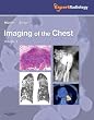Imaging of the Chest (Expert Radiology Series)