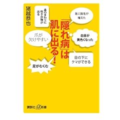 �u�B��a�v�͔��ɏo��I (�u�k�Ѓv���X�A���t�@�V��)