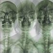 SUPERGRASS