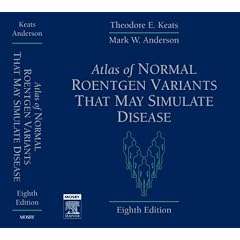 Atlas of Normal Roentgen Variants That May Simulate Disease, 8e