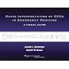 Rapid Interpretation of ECGs in Emergency Medicine: A Visual Guide