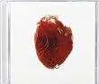 Love Is Simple (W/Dvd)