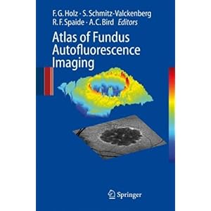 【クリックで詳細表示】Atlas of Fundus Autofluorescence Imaging [ハードカバー]