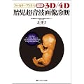 �ŐV3D/4D�َ������g�摜�f�f�\�t���J���[�A�g���X