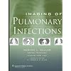Imaging of Pulmonary Infections