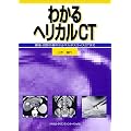 �摜�f�f �Տ���w �킩��w���J��CT�\�B���E�ǉe�̊�{����}���`�X���C�XCT�܂�