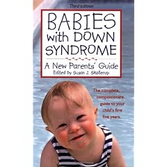Babies With Down Syndrome: A New Parents' Guide