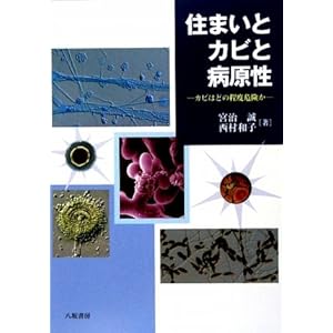 �Z�܂��ƃJ�r�ƕa�����\�J�r�͂ǂ̒��x�댯��