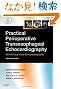 Practical Perioperative Transesophageal Echocardiography: Text with DVD-ROM, 2e