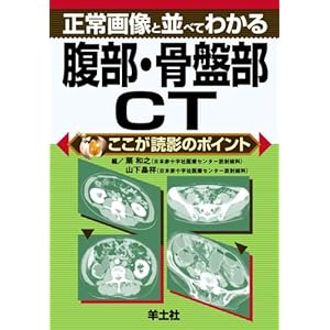 【クリックで詳細表示】正常画像と並べてわかる腹部・骨盤部CT (ここが読影のポイント) [文庫]