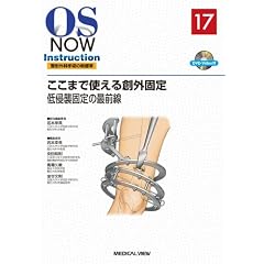 �����܂Ŏg����n�O�Œ�|��N�P�Œ�̍őO�� (OS NOW Instruction No.17)