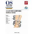 �����܂Ŏg����n�O�Œ�|��N�P�Œ�̍őO�� (OS NOW Instruction No.17)