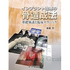�C���v�����g���Â̍������@�\��b�m���ƗՏ��e�N�j�b�N