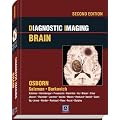 Diagnostic Imaging: Brain