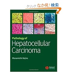 Pathology of Hepatocellular Carcinoma