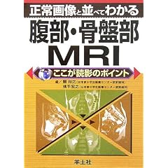 ����摜�ƕ��ׂĂ킩�镠���E���Օ�MRI�\�������ǉe�̃|�C���g