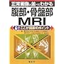 ����摜�ƕ��ׂĂ킩�镠���E���Օ�MRI�\�������ǉe�̃|�C���g