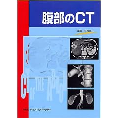 ������CT