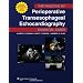 The Practice of Perioperative Transesophageal Echocardiography: Essential Cases