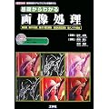 ��b����킩��摜�����\�摜�����̃A���S���Y���𗝉����� (I�EO BOOKS)