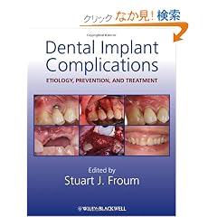 Dental Implant Complications: Etiology, Prevention, and Treatment