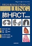 �xHRCT