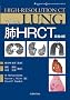 �xHRCT