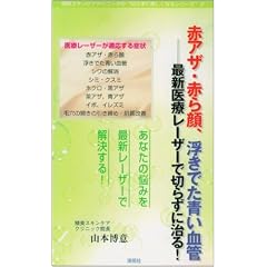 �ԃA�U�E�Ԃ��A�����ł������ǁ\�ŐV��Ã��[�U�[�Ő؂炸�Ɏ���! (�����X�L���P�A�N���j�b�N�̐؂炸�ɔ������Ȃ�V���[�Y 2)