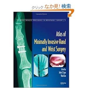 【クリックでお店のこの商品のページへ】Atlas of Minimally Invasive Hand and Wrist Surgery (Minimally Invasive Procedures in Orthopaedic Surgery): John T. Capo, Virak Tan: 洋書