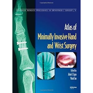 【クリックで詳細表示】Atlas of Minimally Invasive Hand and Wrist Surgery (Minimally Invasive Procedures in Orthopaedic Surgery)： John T. Capo， Virak Tan： 洋書