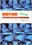 �d���O�����\MLA(Modified Laminar Approach)�ɂ����h�Ɩ����Ǘ�