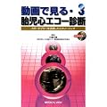 ����Ō���E�َ��S�G�R�[�f�f 3�|�J���[�h�v���[�����p�����X�N���[�j���O