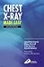 CHEST X-RAY MADE EASY