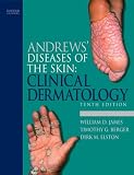 Andrews' Diseases of the Skin: Clinical Dermatology