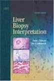 Liver Biopsy Interpretation