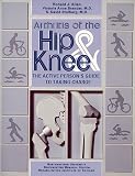 Arthritis of the Hip and Knee: The Active Person\'s Guide to Taking Charge