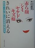 赤ら顔・シミ・ヤケド・キズ痕きれいに消える―肌われ・ニキビ痕にも効果抜群の再生法