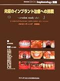 究極のインプラント治療への挑戦―オッセオインテグレイション・スタディクラブ・オブ・ジャパン