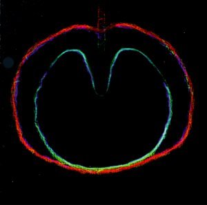 Wasp Star (Apple Venus Volume 2) by XTC album cover