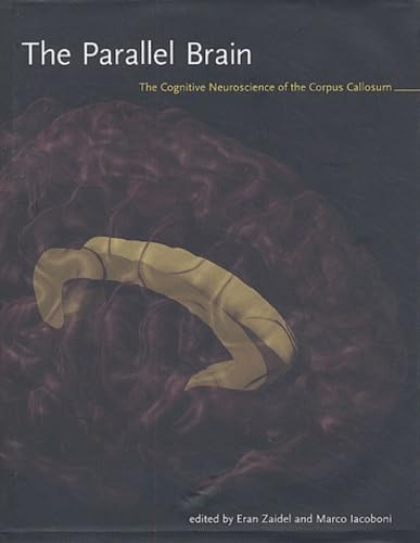 The Parallel Brain Cover