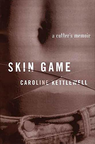 Skin Game: A Memoir Poster