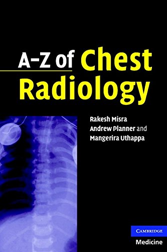 A-Z of Chest Radiology Cover