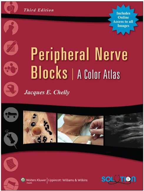 Peripheral Nerve Blocks Cover