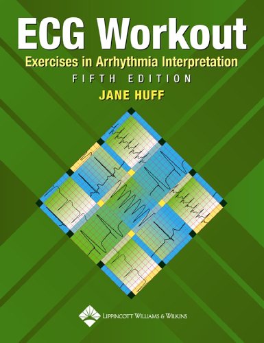 ECG workout Cover